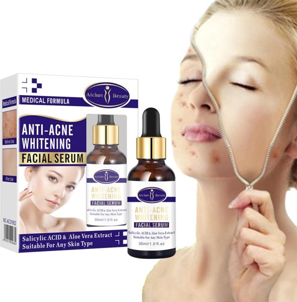 Aichun Beauty Anti – Acne Whitening Facial Serum