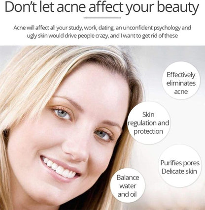 Aichun Beauty Anti – Acne Whitening Facial Serum